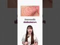 เช็คเลย! ผิวติดสารเป็นยังไง? 😱