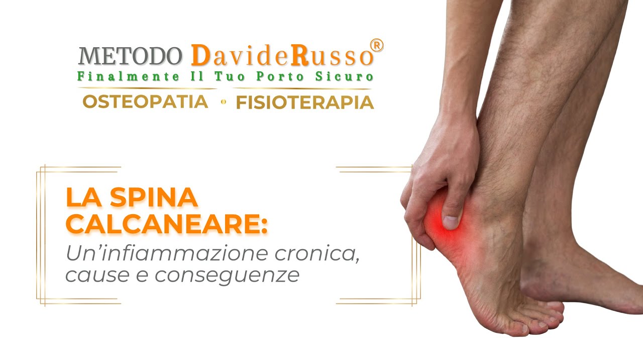 LA SPINA CALCANEARE: UN’INFIAMMAZIONE CRONICA