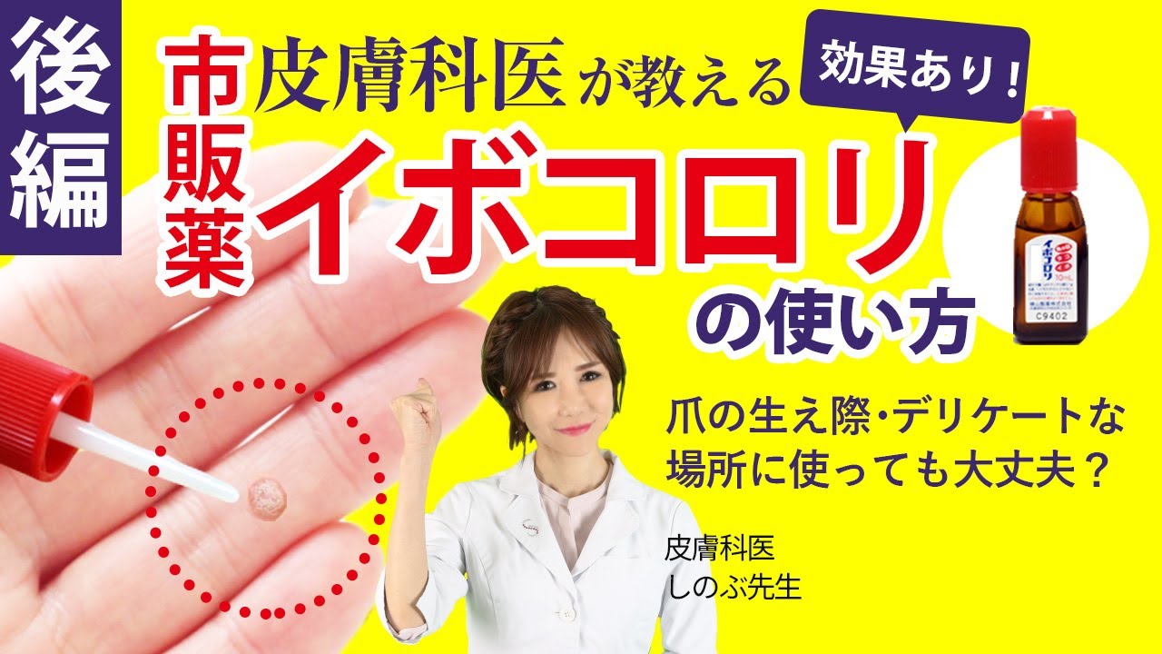後編【イボコロリの効果的な使い方】イボはピンセットで取っても大丈夫