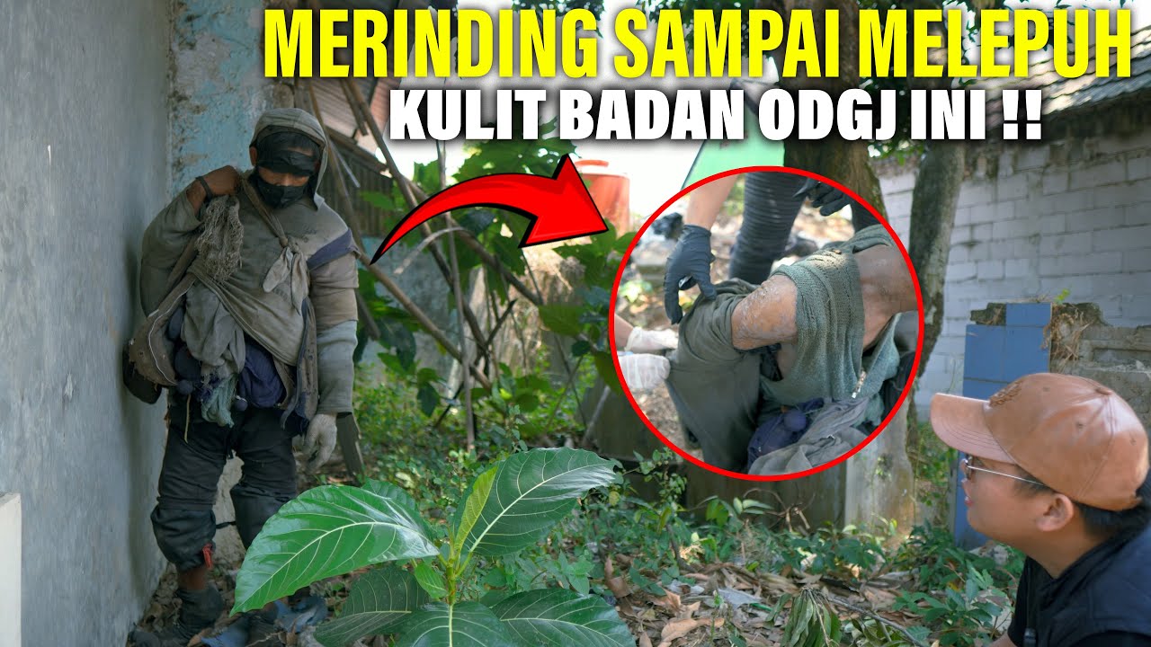 Merinding !! Pas kita buka puluhan lapis baju di badan nya, kok bisa seperti ini..??