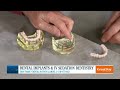 Dental Implants and IV Sedation Dentistry