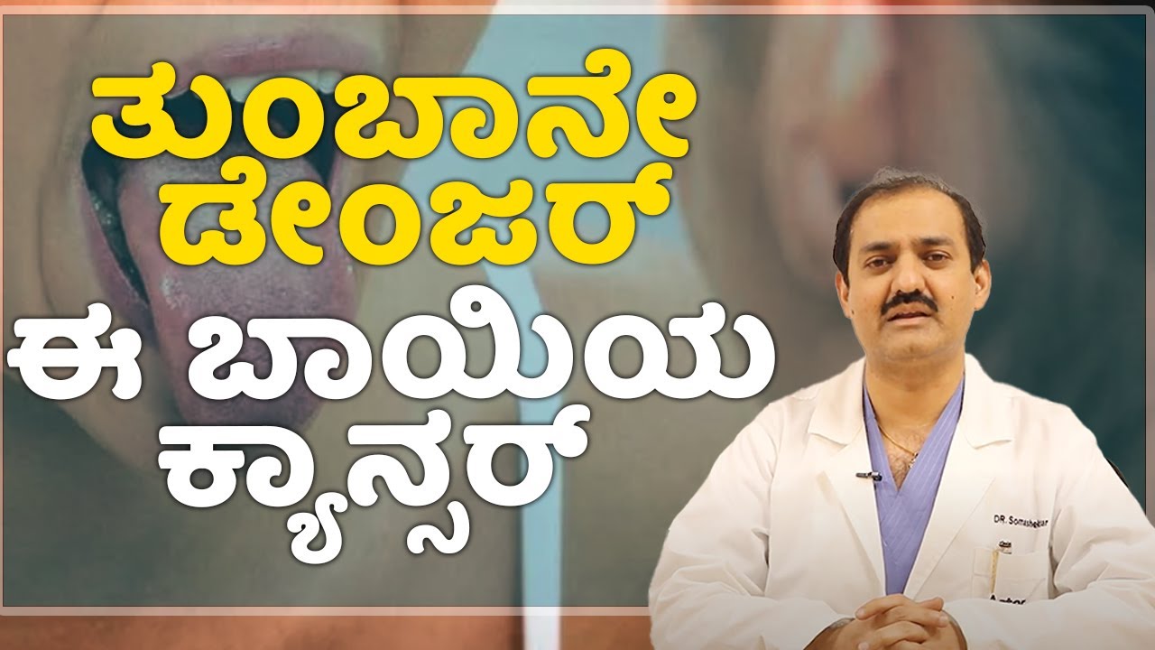 Oral Cancer: Symptoms, and Prevention | Vijay Karnataka