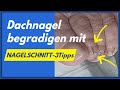 Dachnagel begradigen? Nur mit Nagelschnitt? 3 Tipps verändern die Nagelform