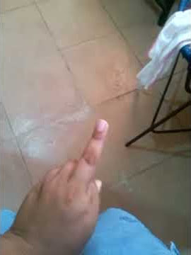 dedo