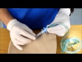 Needle Cricothyroidotomy