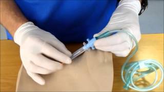 Needle Cricothyroidotomy