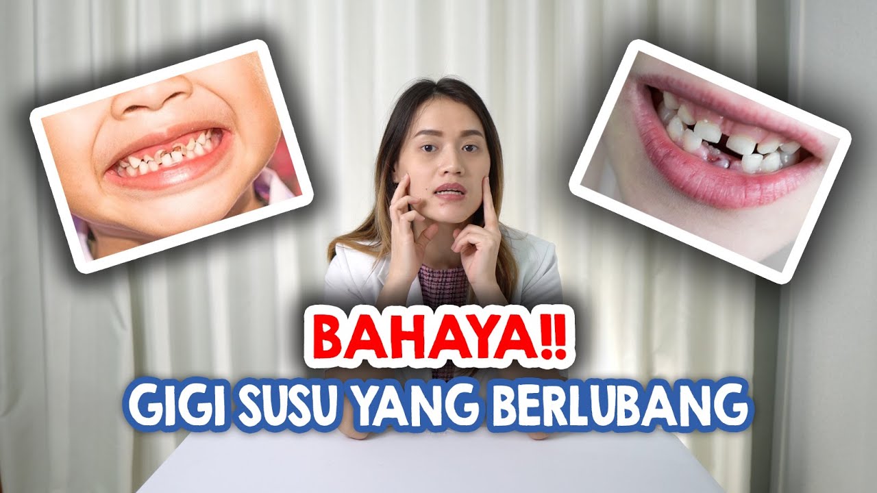 Cara Merawat Gigi Susu Anak yang Berlubang, Perlu Dicabut? YouTube