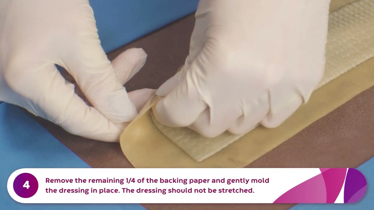 AQUACEL Ag Advantage Surgical Removal and Application Video