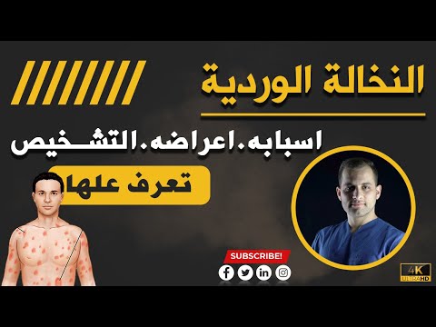   النخالة الوردية