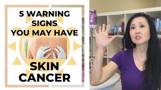 5 Warning Signs You May Have Skin Cancer