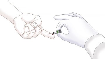 Eurolyser Medica Presentation 2