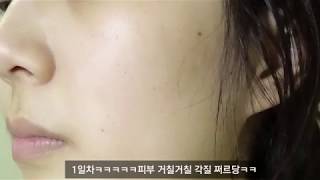 Chica Y Chico Beta-Salic 換膚乳霜2.0