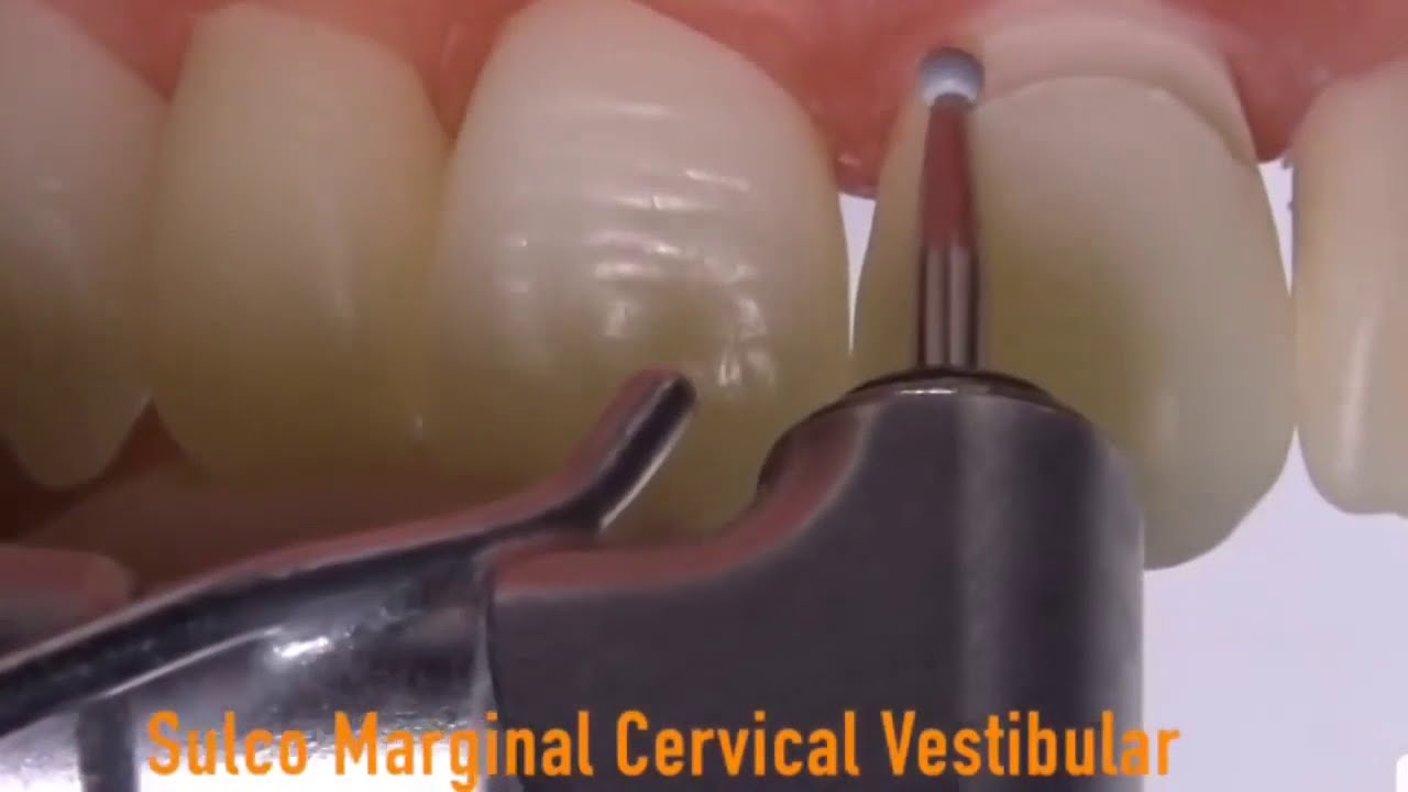 برد الاسنان