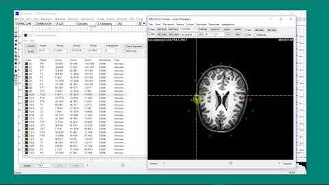 Setup electrodes for EEG channels