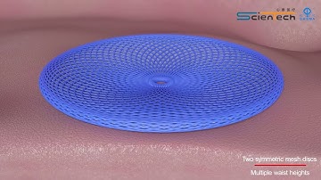 MemoSorb® :one and only fully bio-degradable occluder devices