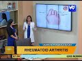 Good Morning Kuya: Understanding Rheumatoid Arthritis