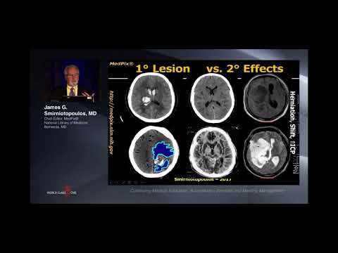 Differential diagnosis in Neuroimaging