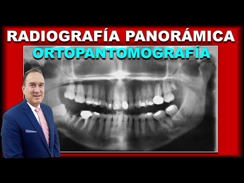 Vídeo: Per què s'utilitzen les radiografies panoràmiques en odontologia?