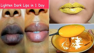 Lighten Dark Lips in 2 Days & Get Baby Soft Lips & Pink Lips !! Lip mask for Dry Lips & Chapped Lips screenshot 4