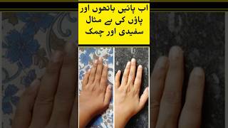 Hand & Feet Whitening Cream The Skin Hub