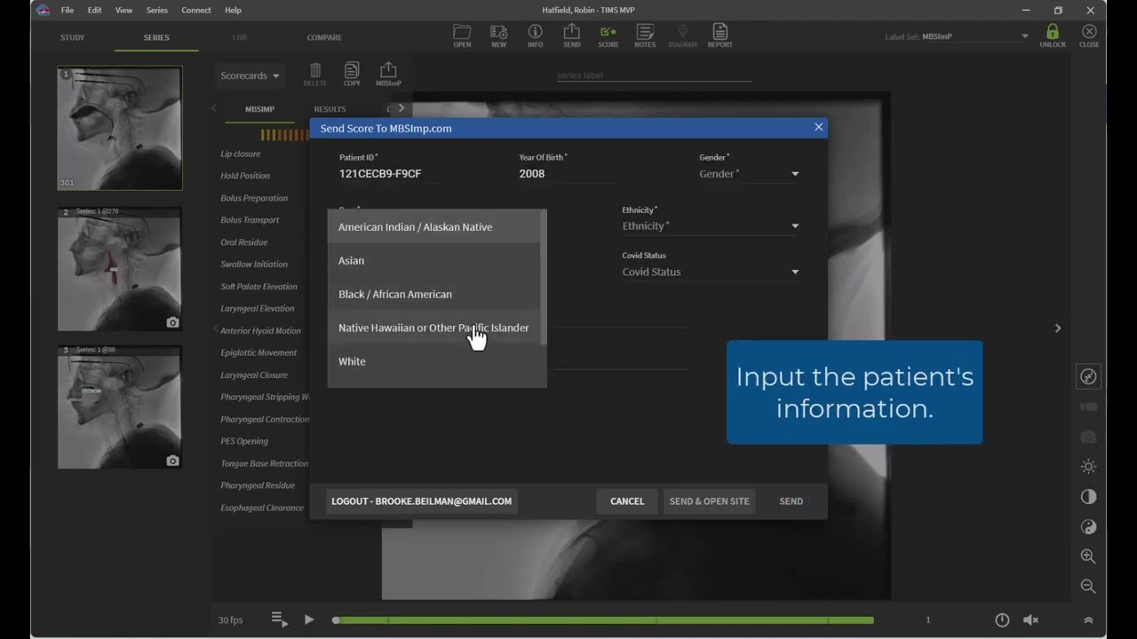 MBSImP Data Registry