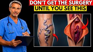 VARICOSE VEINS DISAPPEAR — The 5-Minute Evening Ritual Doctors Never Prescribe