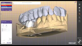 install #Exocad #Exoplan #3Shape #InLab #Cerec #millbox #blueskyplan  #audaxceph   #3shape #blender