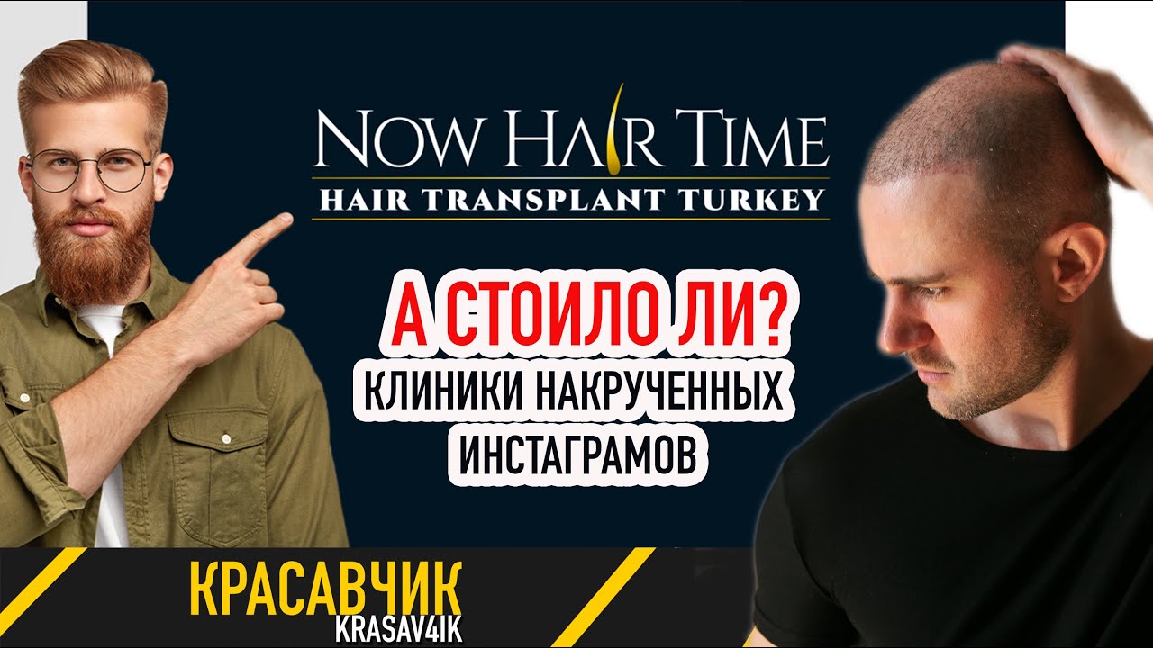 Now Hair Time Clinic. Отзыв о пересадке волос. Как определить