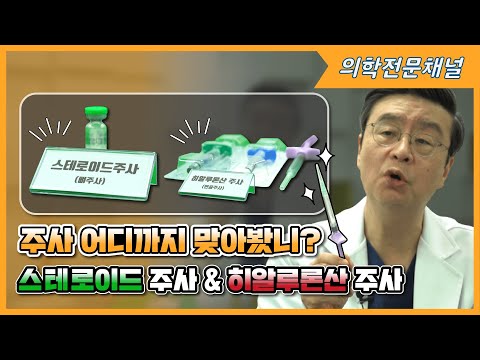 Ep.17 관절염 주사 치료 완전 정복 STEP1.스테로이드 주사 & 히알루론산 주사