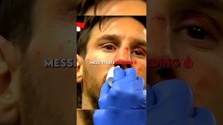 Messis Sweet Revenge