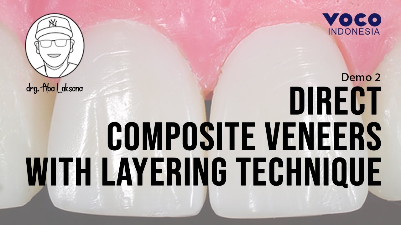Direct Composite Veneers with 2 Layers Technique using AMARIS | Operative Dentistry | VOCO GmbH