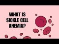 The Genetic Challenges of Sickle Cell Disease