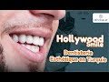 Dentakay | Monsieur Hicham du Maroc a fait Hollywood Smile en Turquie le résultat était incroyable