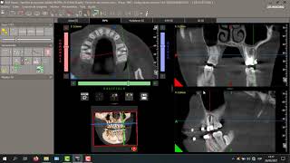 Manejo básico del software Newtom.