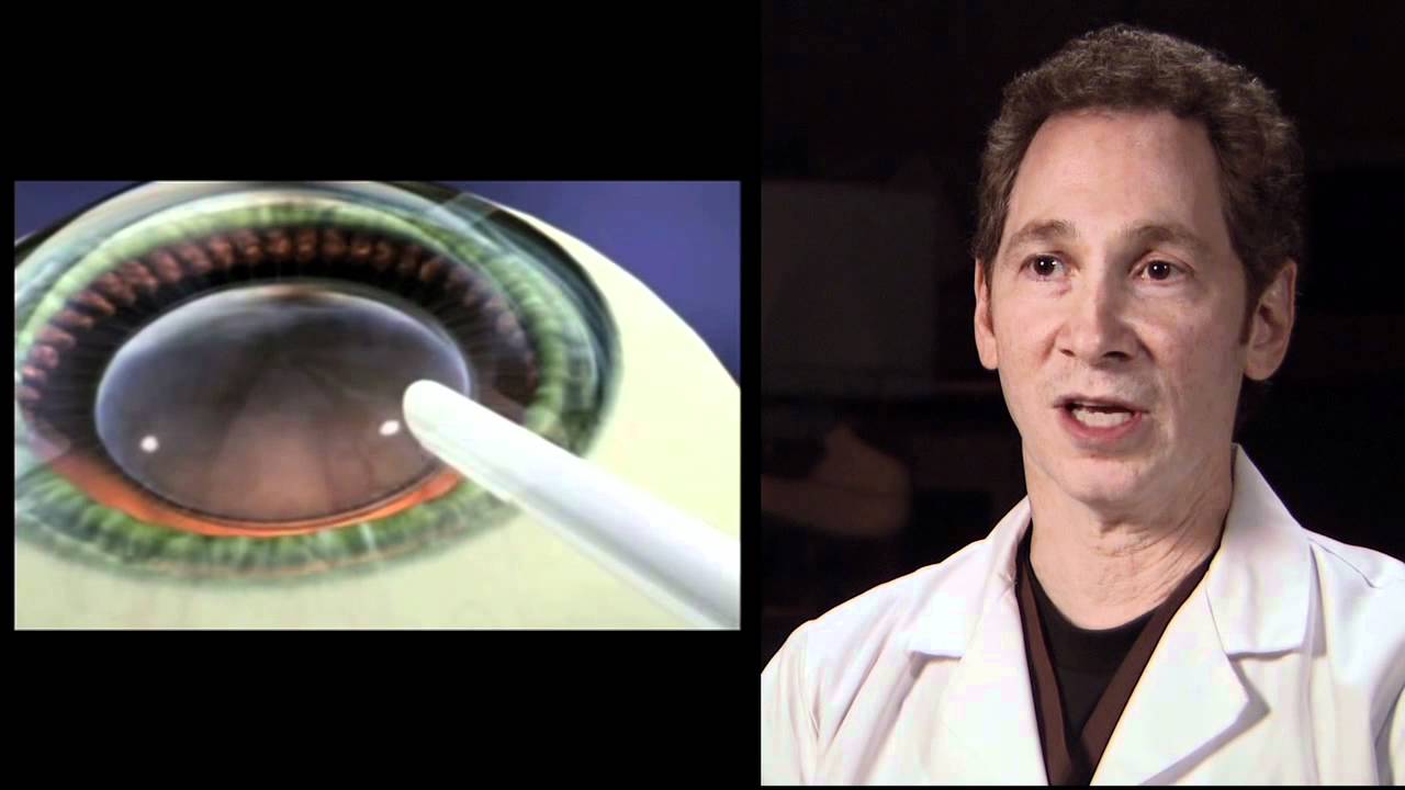 ICL/ Implantable Collamer Lens, Barnet Dulaney Perkins Eye Center (AZ)