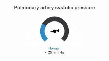 How to estimate pulmonary artery systolic pressure (PASP) using echo