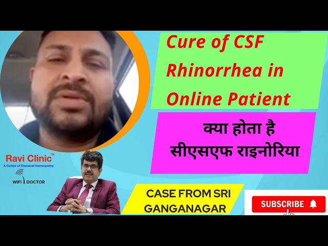 Cure of CSF Rhinorrhea with Homeopathy Dr Ravi Singh