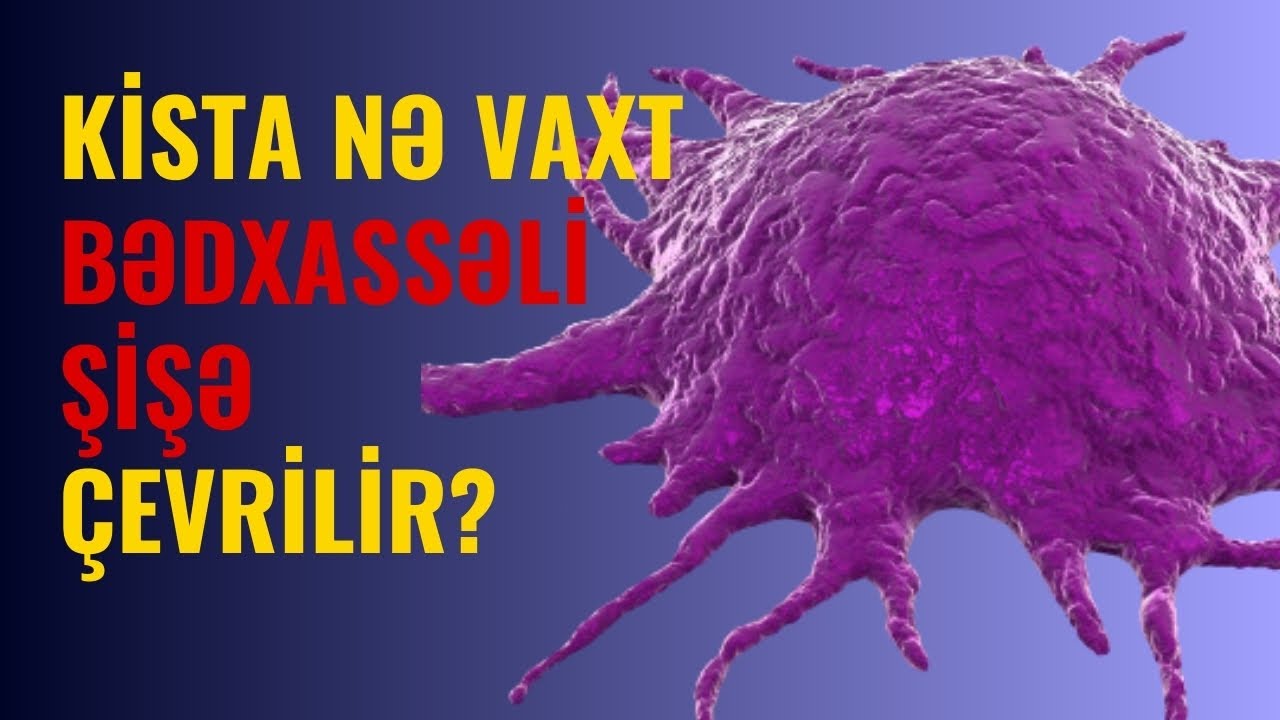 XOŞXASSƏLİ ŞİŞ BƏDXASSƏLİ ŞİŞƏ ÇEVRİLİR? | Onkoloq-Mammoloq İndira Səfərova