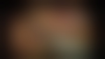 Extended Template Pelvic Lymph Node dissection--"Spaces"