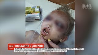 Била, колола голками та морила голодом  – названа мати катувала всиновленого сина