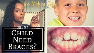 Does your child need braces? Top 2 signs to look for.