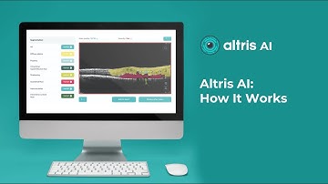 AI for OCT scan interpretation