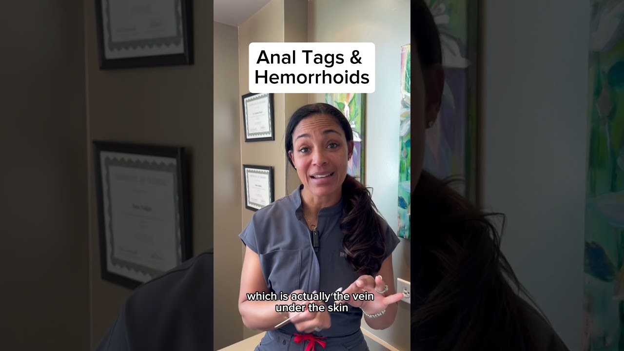 Anal tags & hemorrhoids—no shame! Prevent with fiber, manage with @bydrpoucher (50% off!). 