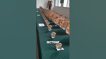 Would You Donate Your Body To Medical Science?