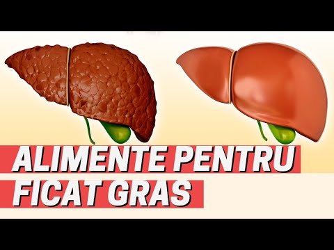 Video: Dieta Cu Sindrom Metabolic: Alimente De Mâncat și Alimente De Evitat