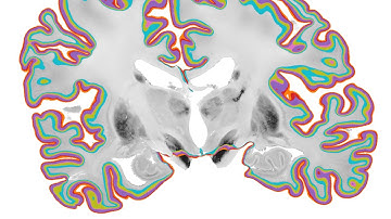 Full pixel-wise segmentation of BigBrain cortical layers by K Wagstyl