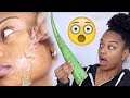 I USED FRESH ALOE VERA ON MY SKIN FOR 5 DAYS AND THIS HAPPENED!