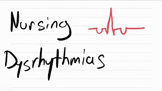 Nursing Dysrhythmias in 15 minutes! (Part 2) screenshot 5