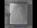 Sidratul Muntarin Shafa 4 Y 13Kg PDA device closure