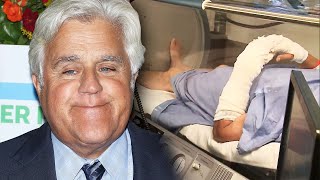 Jay Leno Undergoes Treatment for Severe Burns From Car Fire